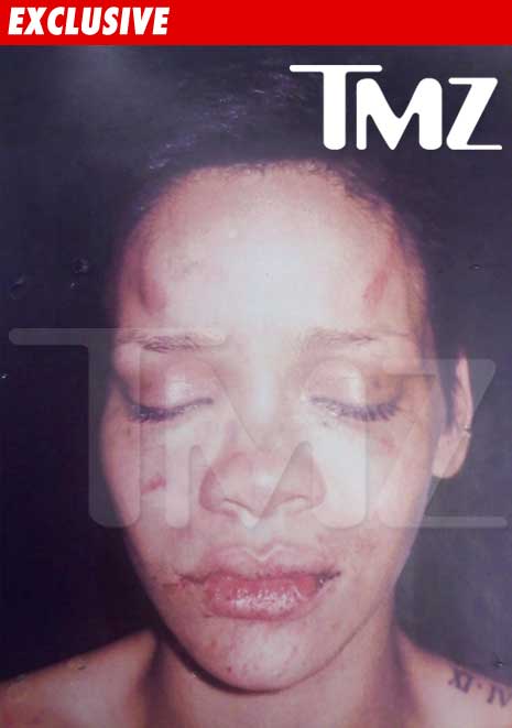 rihanna chris brown fight pictures. Can Chris Brown