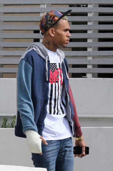chris-brown-hand-cast-1