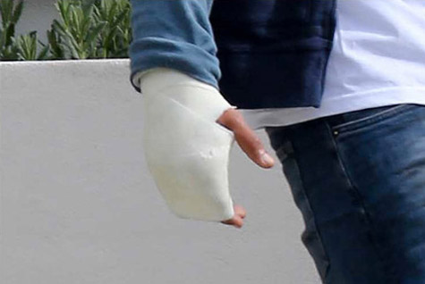 chris-brown-hand-cast-3